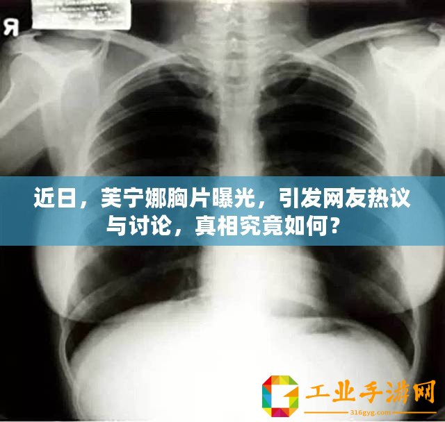 近日，芙寧娜胸片曝光，引發(fā)網(wǎng)友熱議與討論，真相究竟如何？